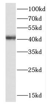 CTSH Rabbit Polyclonal Antibody