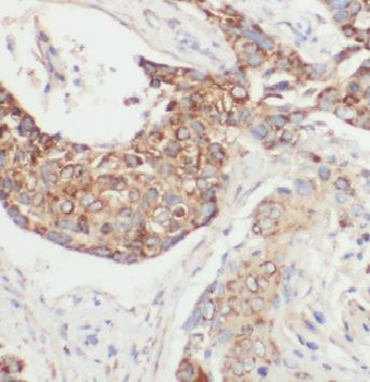 CTSH Rabbit Polyclonal Antibody