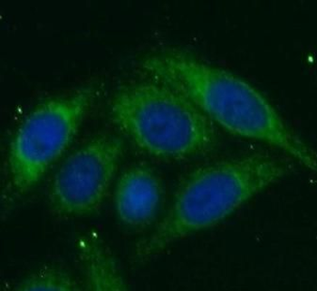 CTSK Rabbit Polyclonal Antibody