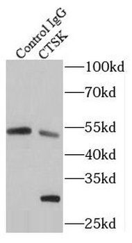 CTSK Rabbit Polyclonal Antibody