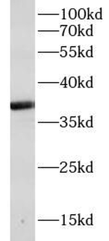 CTSK Rabbit Polyclonal Antibody