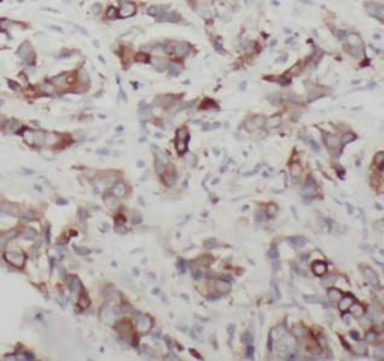 CTSK Rabbit Polyclonal Antibody