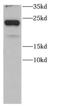 CAV1 Antibody