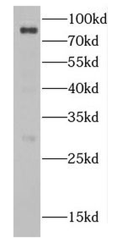 CBFA2T2 Rabbit Polyclonal Antibody