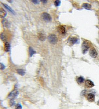 CBFA2T2 Rabbit Polyclonal Antibody