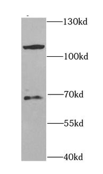 CBLB Rabbit Polyclonal Antibody