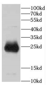 CBLN2 Rabbit Polyclonal Antibody