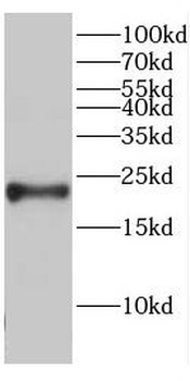 CBLN4 Rabbit Polyclonal Antibody