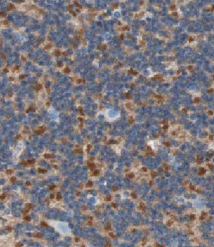 CBLN4 Rabbit Polyclonal Antibody