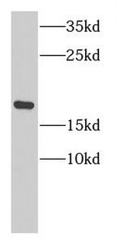 NCBP2 Antibody