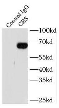 CBS Antibody