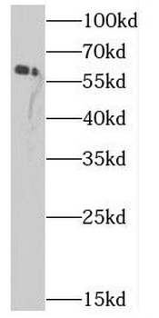 CBS Antibody