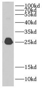 CBX1 Rabbit Polyclonal Antibody