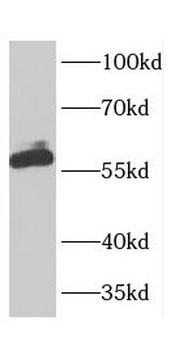 CBX2 Rabbit Polyclonal Antibody