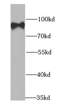 CBX4 Antibody