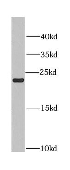 CBX5 Rabbit Polyclonal Antibody