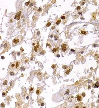 CBX5 Rabbit Polyclonal Antibody