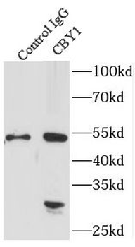 CBY1 Rabbit Polyclonal Antibody
