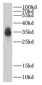 CBY1 Rabbit Polyclonal Antibody