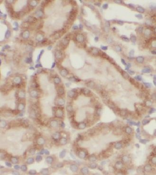 CBY1 Rabbit Polyclonal Antibody