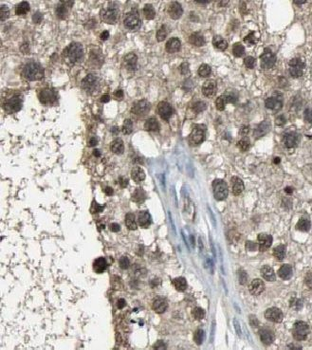 CC2D1A Rabbit Polyclonal Antibody