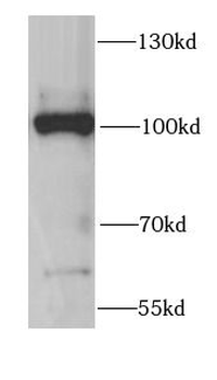 CCAR2 Rabbit Polyclonal Antibody