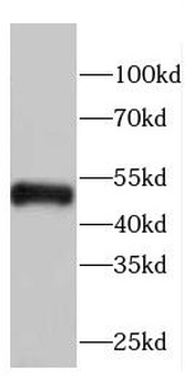 KYAT1 Rabbit Polyclonal Antibody