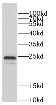 CCDC115 Rabbit Polyclonal Antibody