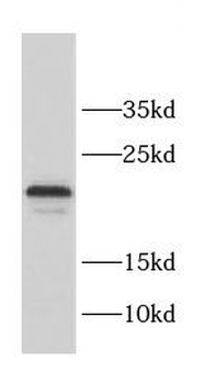 CCDC12 Rabbit Polyclonal Antibody