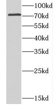 CCDC22 Rabbit Polyclonal Antibody