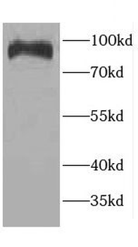 CCDC40 Rabbit Polyclonal Antibody