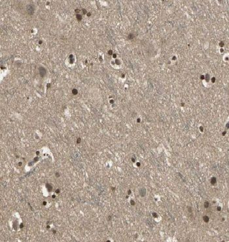 CCDC42 Rabbit Polyclonal Antibody