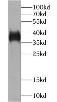 CCDC50 Rabbit Polyclonal Antibody