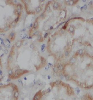 CCDC50 Rabbit Polyclonal Antibody