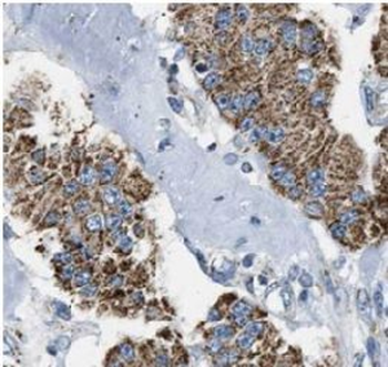 COA3 Rabbit Polyclonal Antibody