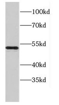 CCDC6 Antibody