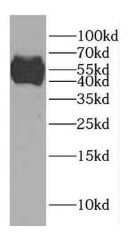 CCDC62 Rabbit Polyclonal Antibody