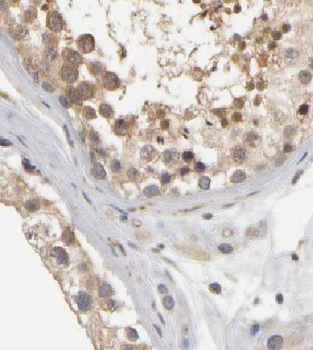 CCDC62 Rabbit Polyclonal Antibody