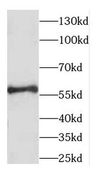 CCDC65 Rabbit Polyclonal Antibody