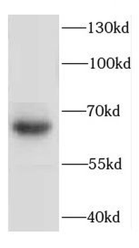 DEUP1 Rabbit Polyclonal Antibody