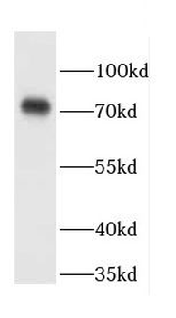 CCDC93 Rabbit Polyclonal Antibody