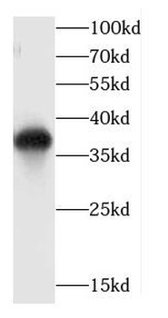YJU2 Rabbit Polyclonal Antibody