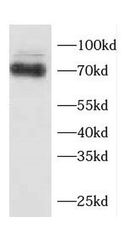 SPDL1 Rabbit Polyclonal Antibody