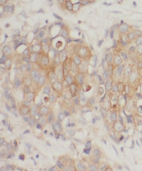 SPDL1 Rabbit Polyclonal Antibody