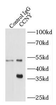 CCNY Rabbit Polyclonal Antibody