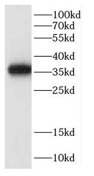 CCNY Rabbit Polyclonal Antibody