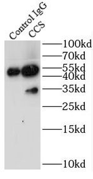 CCS Rabbit Polyclonal Antibody