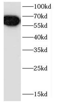 CCT3 Rabbit Polyclonal Antibody