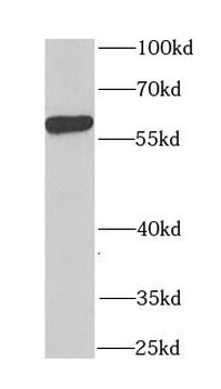 CCT4 Rabbit Polyclonal Antibody