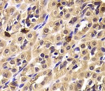 CCT4 Rabbit Polyclonal Antibody